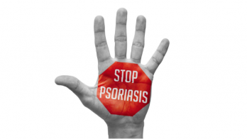 Poor early response to methotrexate portends inadequate long-term outcomes in patients with moderate-to-severe psoriasis: Evidence from 2 phase 3 clinical trials