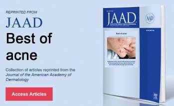 Лучшие статьи по акне, вышедшие в JAAD